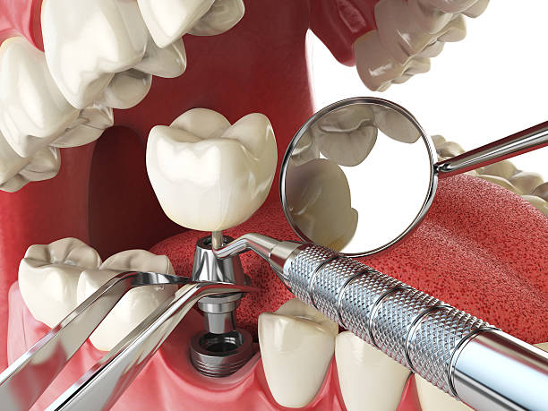 Best Walk-In Emergency Dental Services in Pantego, TX